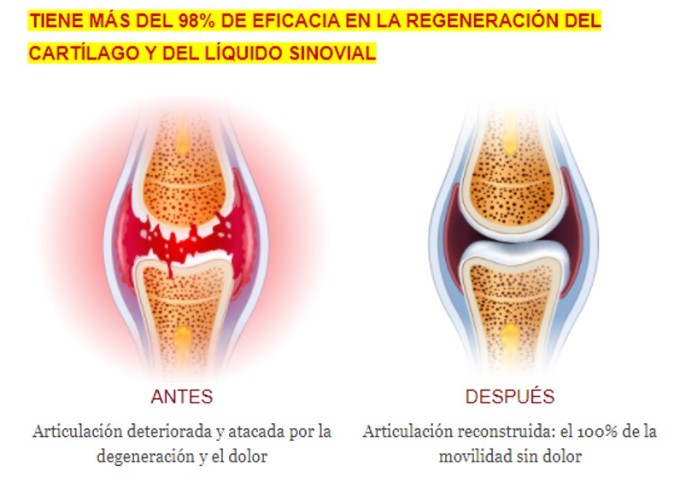 Artrocen max Artrocen max